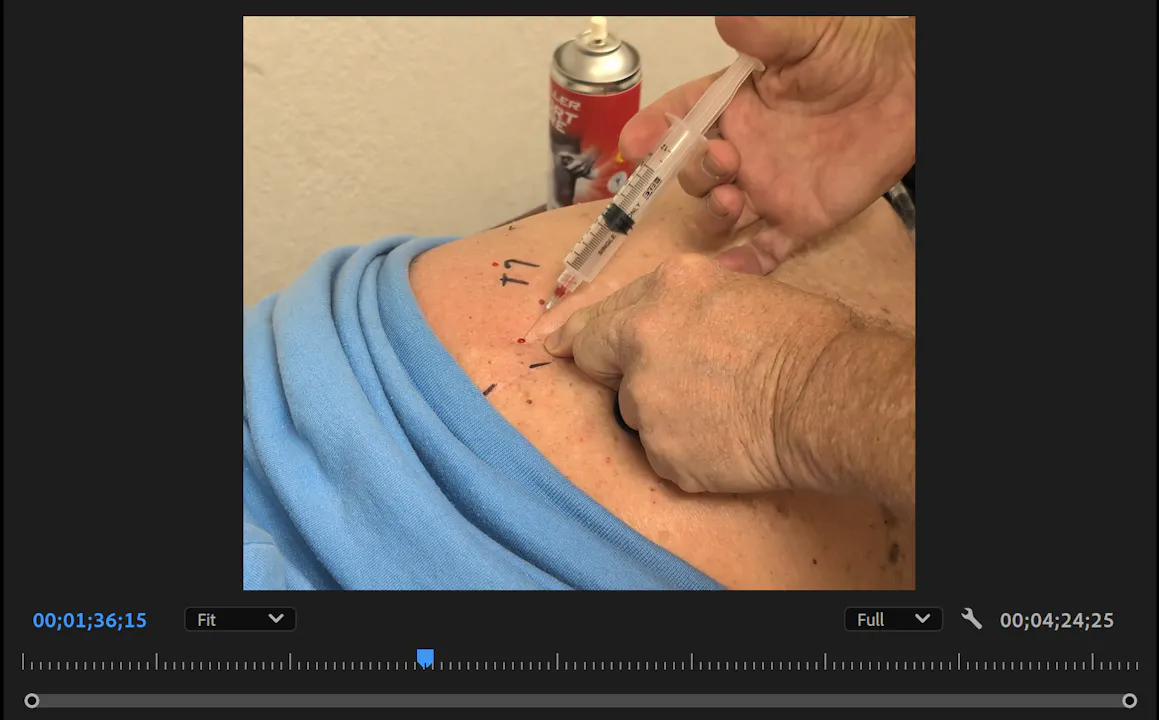 Thoracic Spine Injection - OCBM Roadmap Virtual Video Training Library
