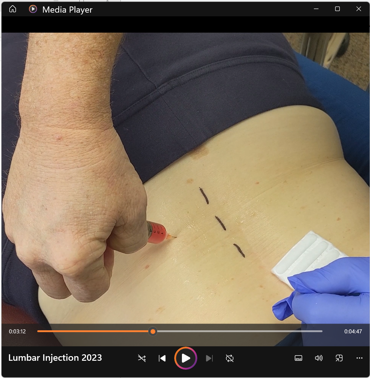 Lumbar Injection + Back Exam & Protocol