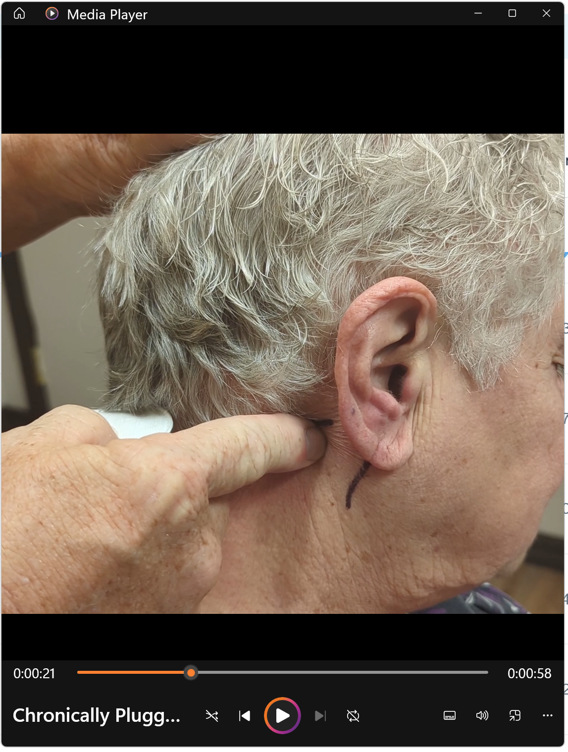 Chronically Plugged Ear Injection