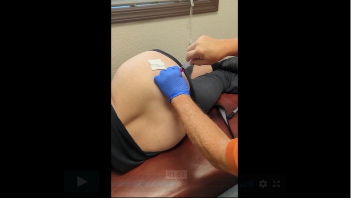 Posterior Hip Injection - Dennis Harper, DC