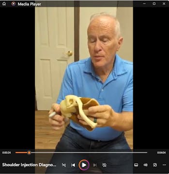 Shoulder - when - why - how