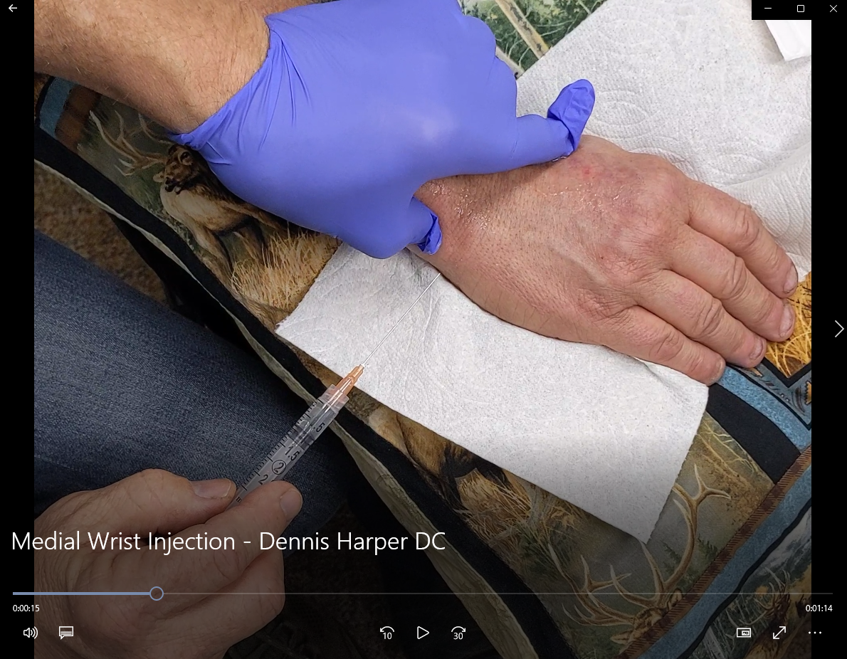 Medial Wrist Injection on Ulnar/Medial Side - Dennis Harper DC