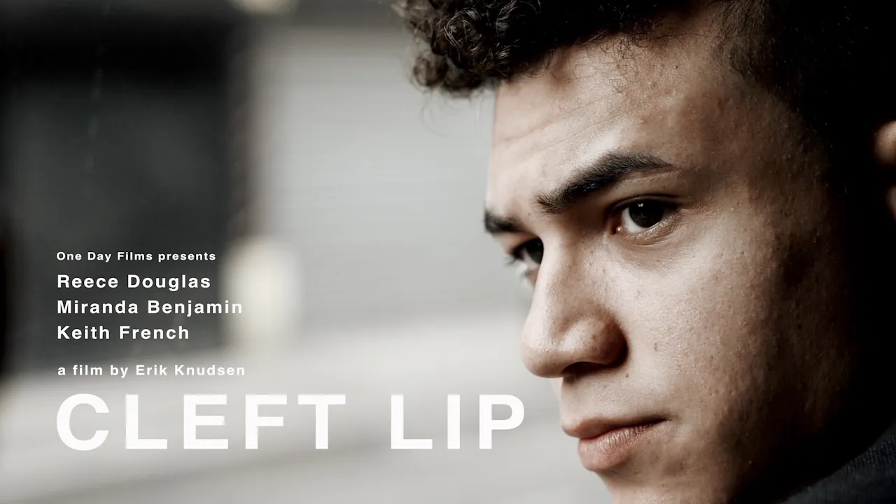 Cleft Lip
