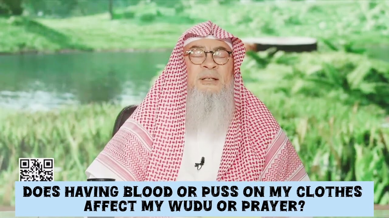 Does Having Blood Or Pus On My Clothes Affect My Wudu Or Prayer?