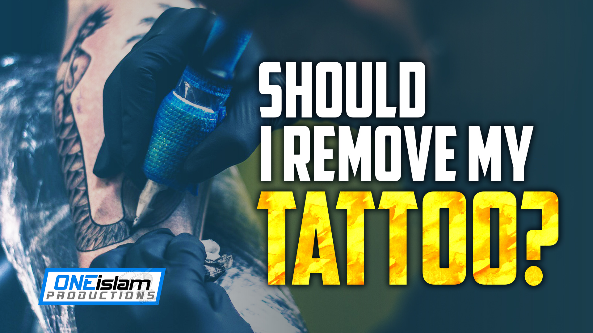SHOULD I REMOVE MY TATTOO?