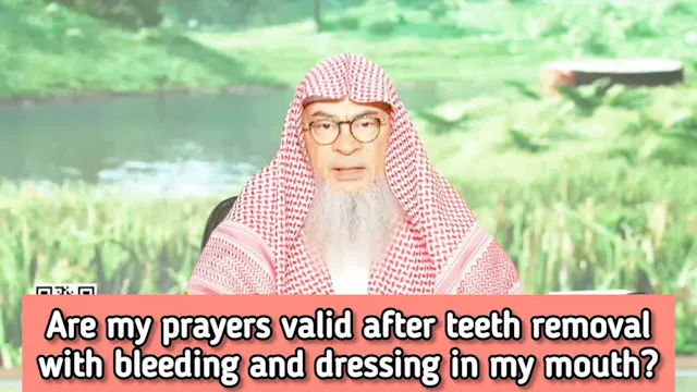 Are My Prayers Valid After Teeth Remo...