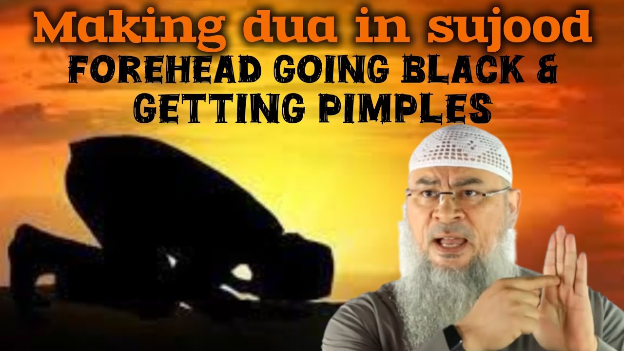 My Forehead Is Going Black & Getting Pimples From Making Dua In Sujood