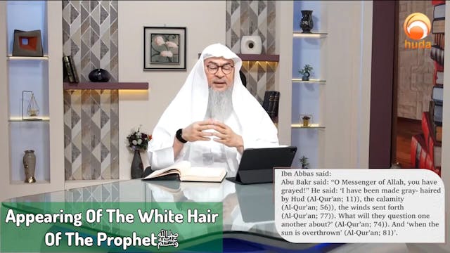 Did Prophet have white hair(Character...