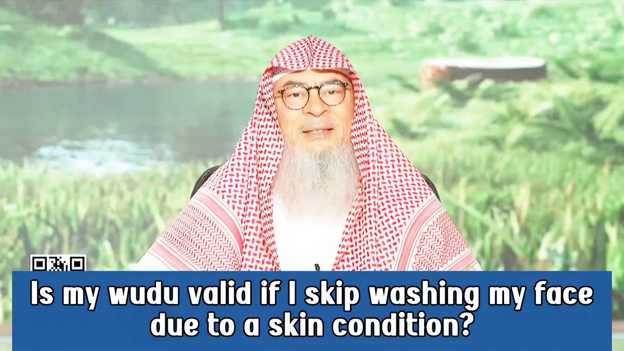 Is My Wudu Valid If I Skip Washing My Face Due To A Skin Condition?