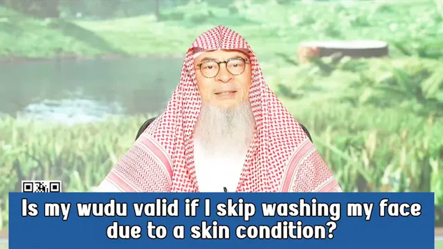 Is My Wudu Valid If I Skip Washing My...