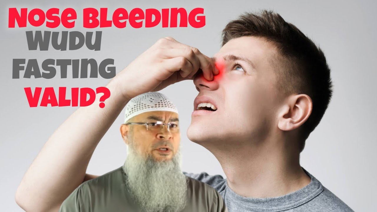Does nose bleeding invalidate my wudu & fasting 