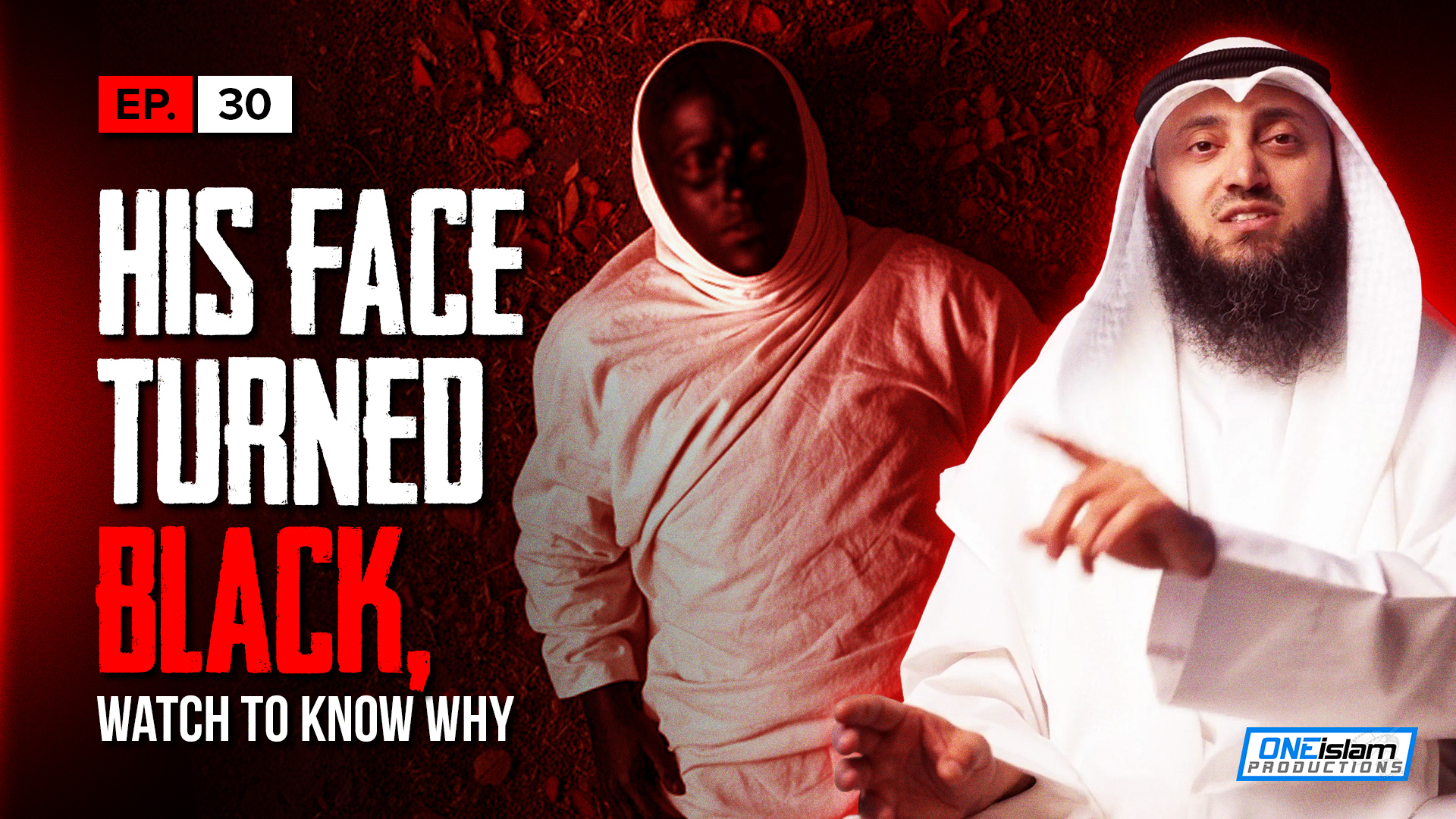 His Face Turned Black, This Is Why | EP30 | S1