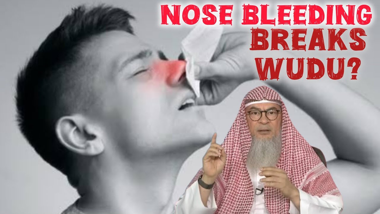 Does nose bleeding invalidate my wudu 