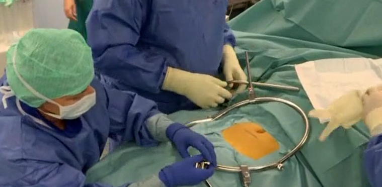 ALIF L5/S1 in an adolescent patient with osteochondrosis