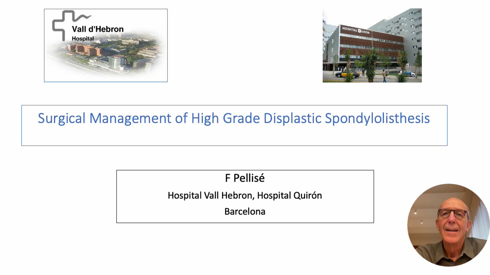 Surgical Management of High Grade Displastic Spondylolisthesis