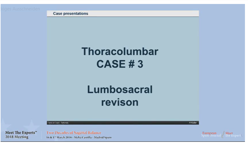 Lumbosacral revision; case presentations