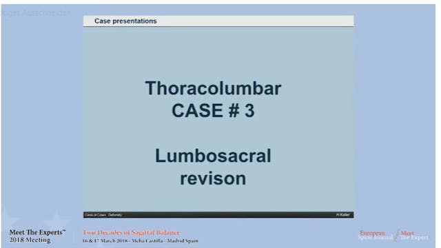 Lumbosacral revision; case presentations