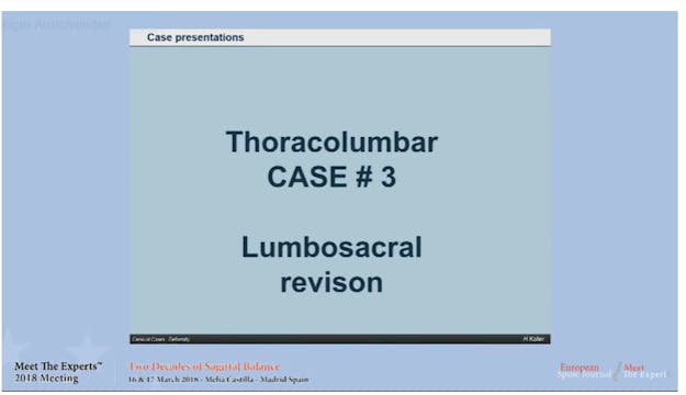 Lumbosacral revision; case presentations