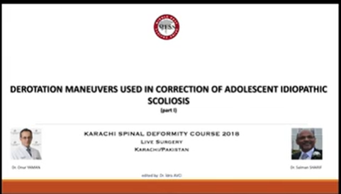 Derotation maneuvers used in correction of adolescent idiopathic scoliosis