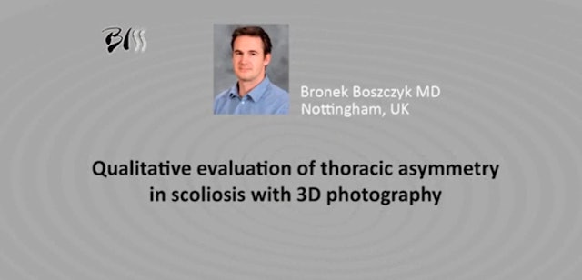 Qualitative evaluation of thoracic asymmetry in scoliosis with 3D photography