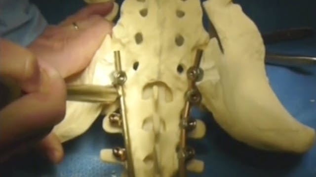 Masterclass 5.5  Malformation and def...