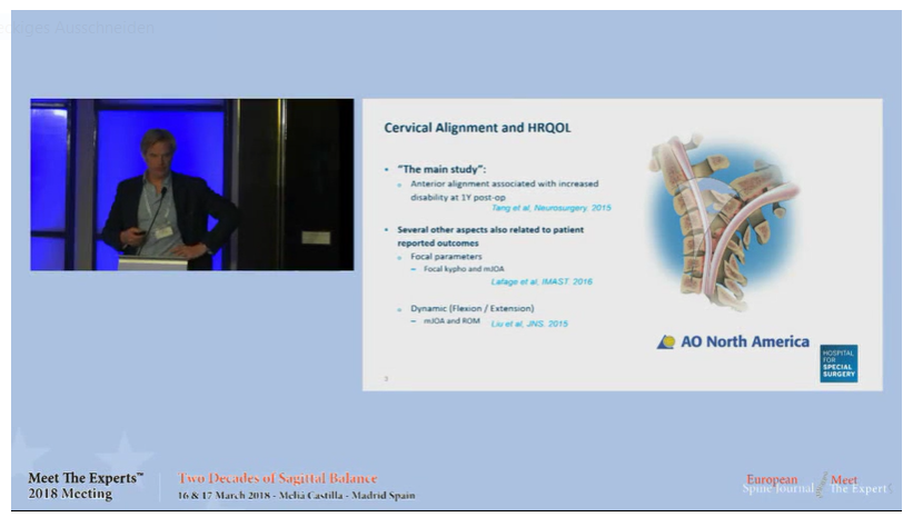 Cervical alignment and HRQOL