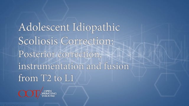 Masterclass 2.2 Adolescent idiopathic scoliosis correction