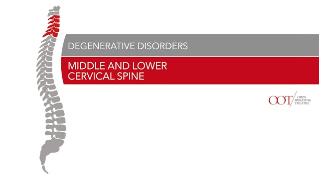 Middle and lower cervical spine - Degenerative Disorders