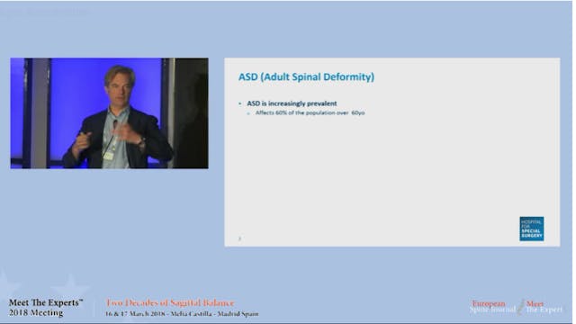 ASD (Adult spinal deformity)