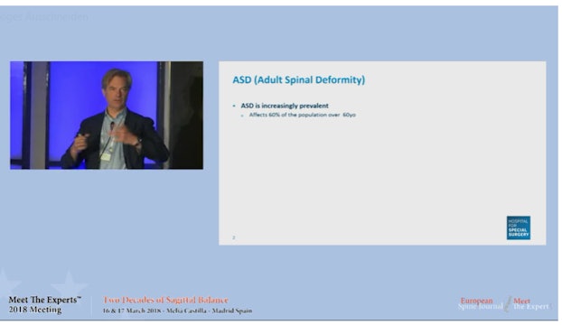 ASD (Adult spinal deformity)