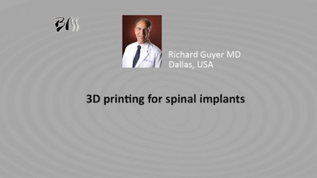 3D printing for spinal implants
