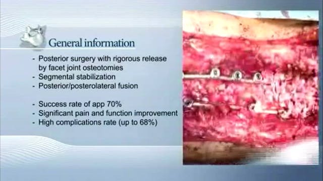 Correction and stabilization of a dou...