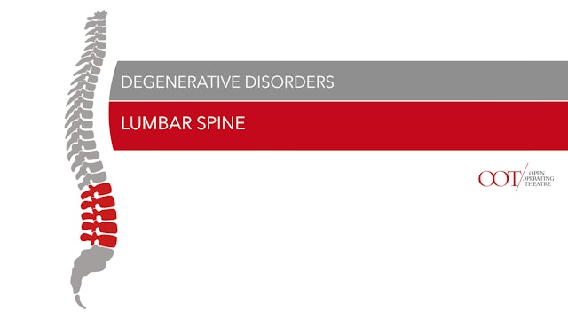 Lumbar spine - Degenerative Disorders