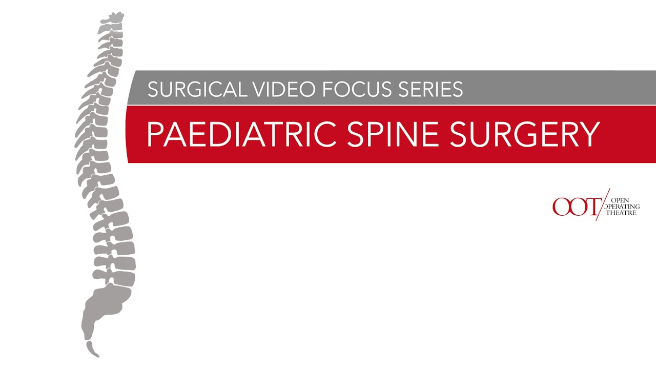 Surgical video focus series: PAEDIATRIC Spine Surgery
