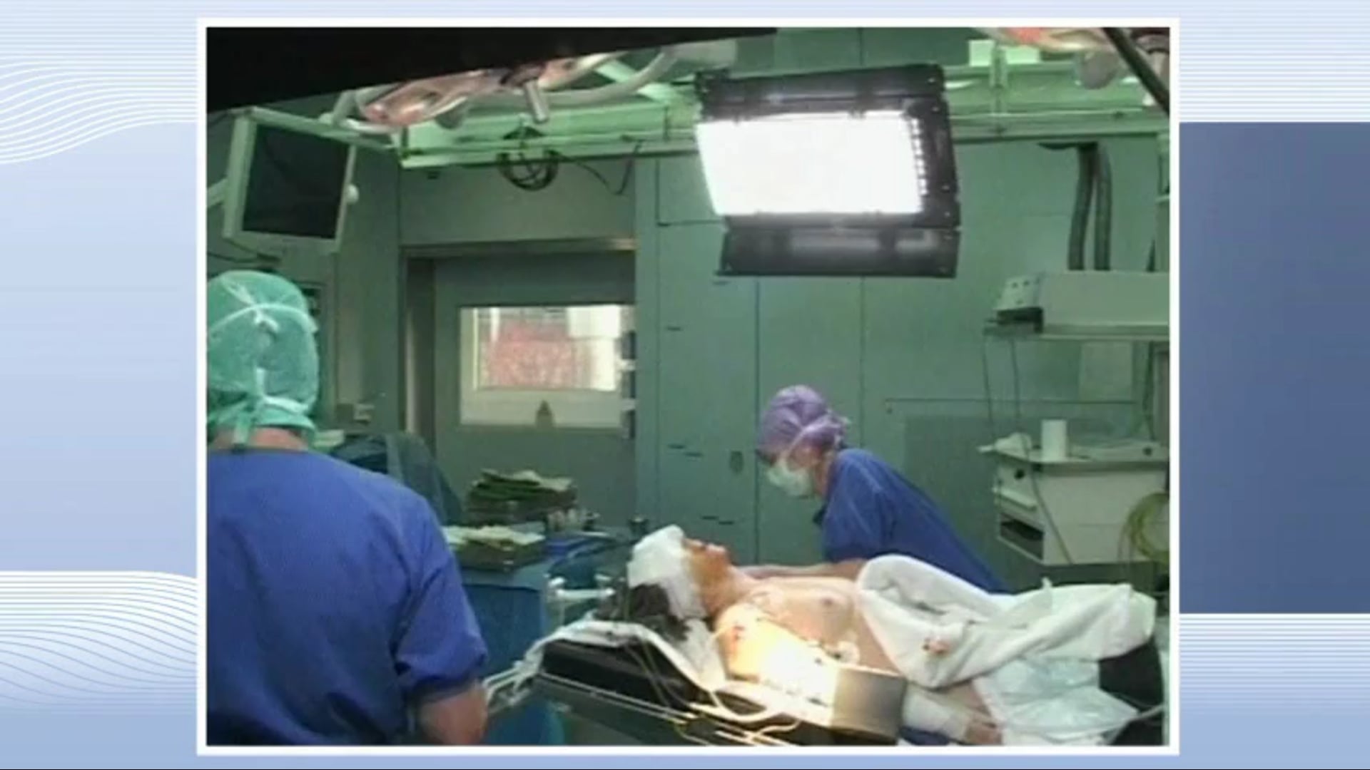 Fusion in craniocervical malformation