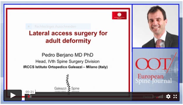 Lateral access surgery for adult defo...