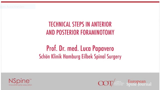 Technical steps in anterior and posterior foraminotomy