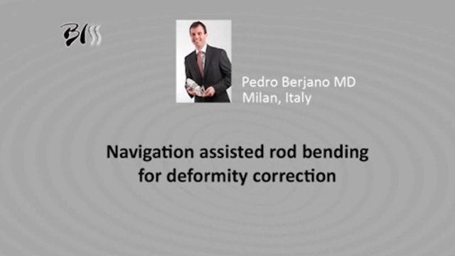 Navigation assisted rod bending for deformity correction