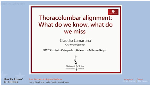 Thoracolumbar alignment: What do we know, what do we miss