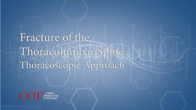 Masterclass 3.1 Fracture of the thoracolumbar spine: Thorascopic approach