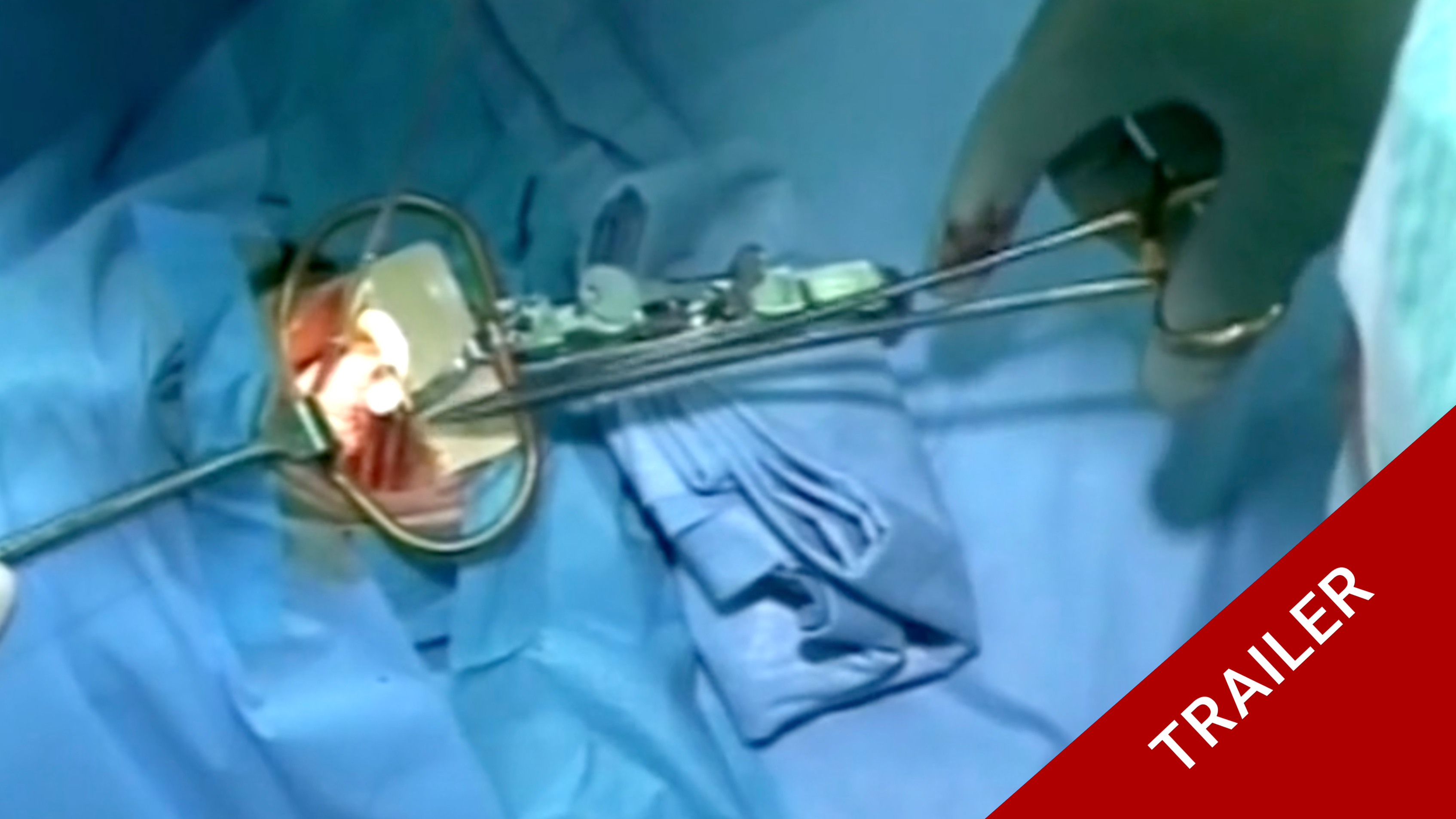 Trailer Masterclass 5.1 Cranio-cervical-junction malformation