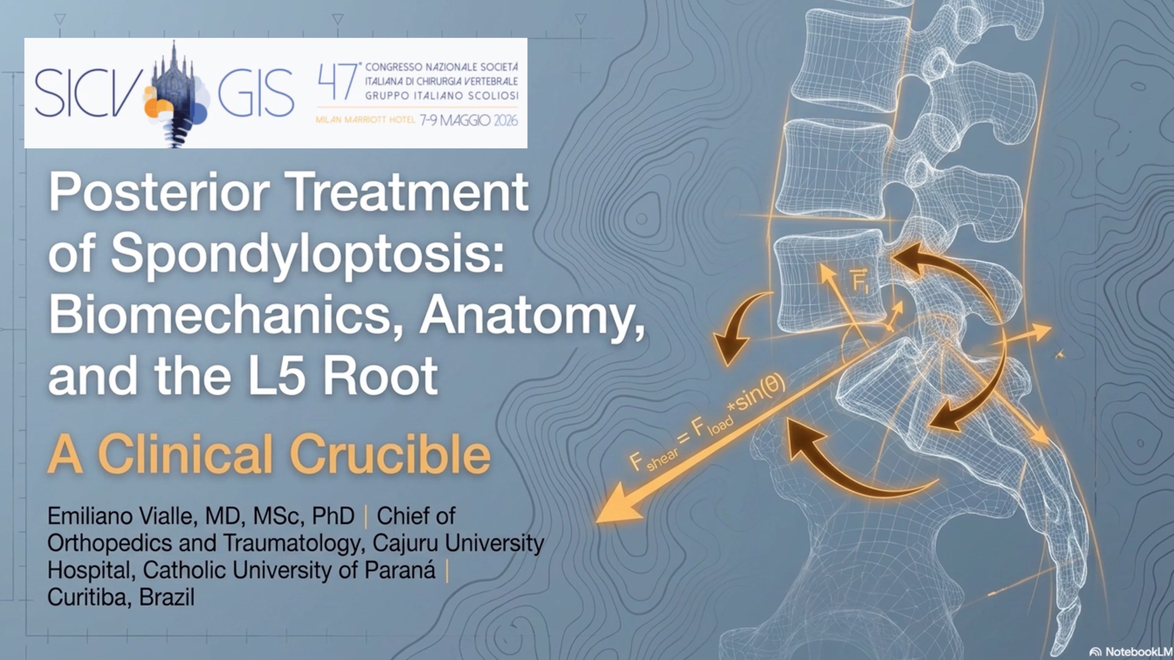 Posterior Treatment of Spondyloptosis: Biomechanics, Anatomy and the L5 root
