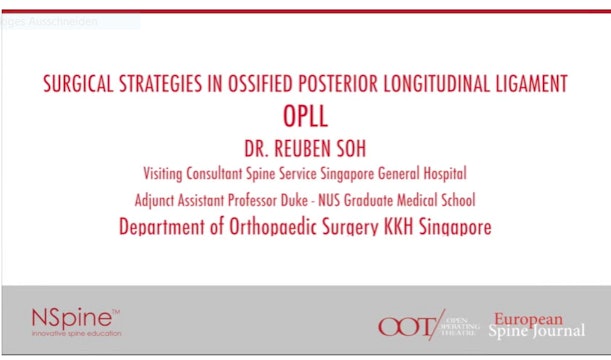 Surgical strategies in ossified posterior longitudinal ligament