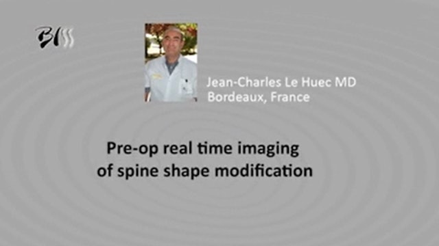 Pre-op real time imaging of spine shape modification