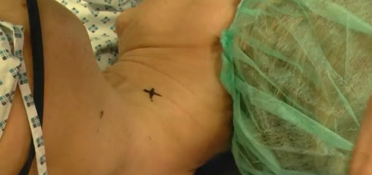 Lumbar and cervical injection techniques