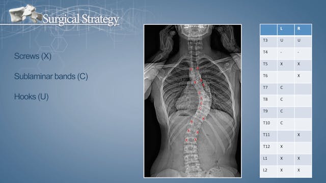 Correction of an AIS with a hybrid te...