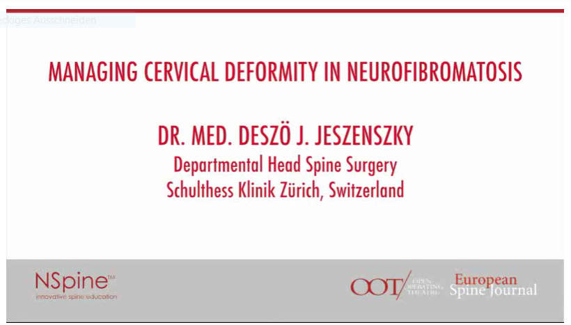 Managing cervical deformity in neurofibromatosis