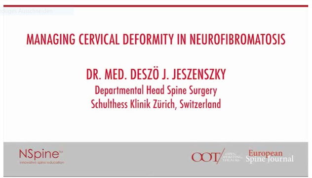 Managing cervical deformity in neurofibromatosis