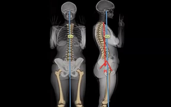 WFNS Spine Committee Webinar 2020: Ad...