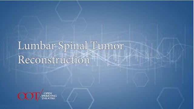 Masterclass 3.3 Lumbar spinal tumor reconstruction